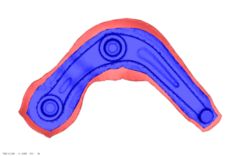 Automatic optimization FORGE 2